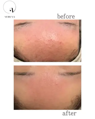 オーダーメイドハーブ ピーリングOPEN✨のエステ・リラクイメージ