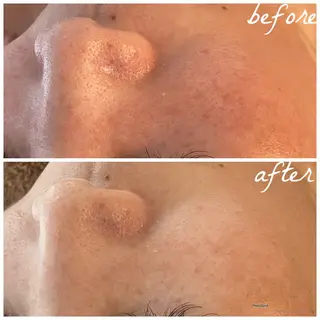 メンズ メナード岐阜市茜部 杉浦のエステ・リラクイメージ