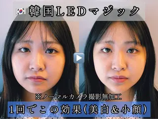 小顔美容鍼専門サロン 渋谷YZのエステ・リラクイメージ