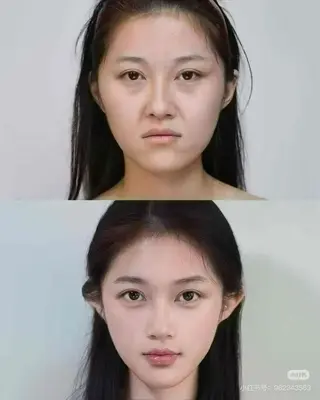 ネイル aliaハイフ&水光ジェットサロン所属・aliaハーブ水光店 エステティシャン募集のエステ・リラクイメージ