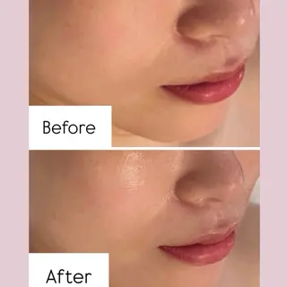 リフトアップ小顔 専門のエステ・リラクイメージ