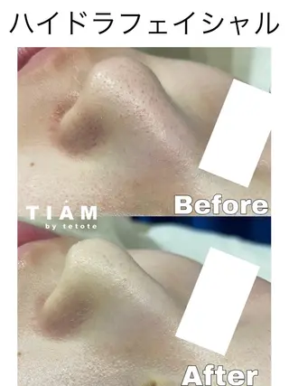 美肌サロンTIAM by tetoteのエステ・リラクイメージ