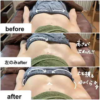 育乳痩身バストアップサロン　つばききよら所属・育乳痩身バストアップ サロン　つばききよらのエステ・リラクイメージ