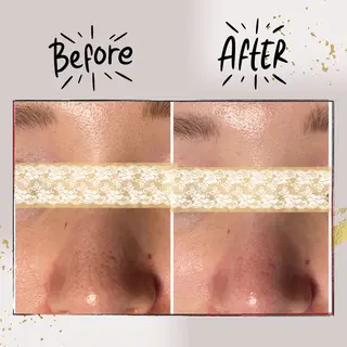 ピーリング専門店 Belluteのエステ・リラクイメージ