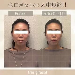 tres girasol🌻のエステ・リラクイメージ