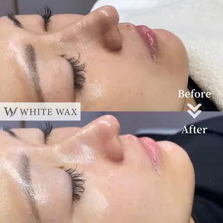 フェイシャルワックス KANAKOのエステ・リラクイメージ