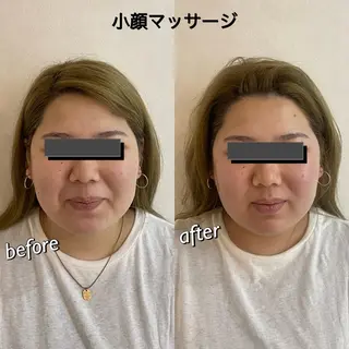 うなじ脱毛/美肌脱毛 LABELのエステ・リラクイメージ