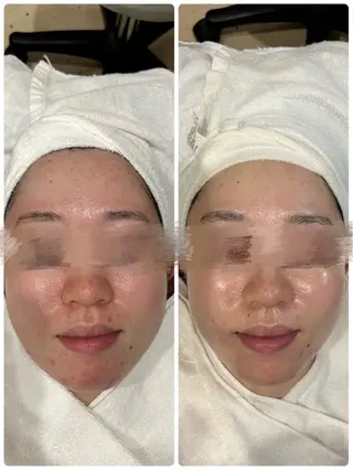 ˚⟡ suwan .˚⟡のエステ・リラクイメージ