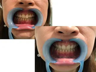 アイブロウ マツエク・マツパ ネイル キッズ カラー パーマ ヘアアレンジ メンズ ショート 中目黒 ホワイトニングサロンのその他イメージ