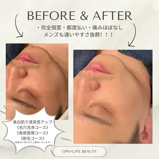 メンズ OPS×LIFE BEAUTY/maiのエステ・リラクイメージ