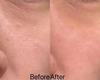 Ginza Charerのエステ・リラクイメージ