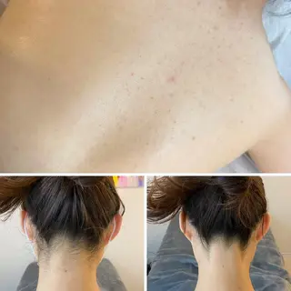 うなじ脱毛/美肌脱毛 LABELのエステ・リラクイメージ