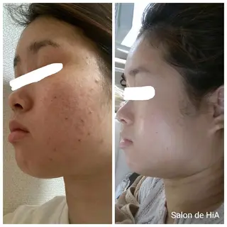 Salon de  HiAのエステ・リラクイメージ