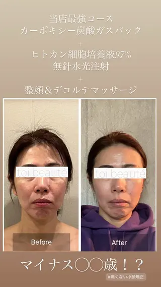 柳瀬 絵美のマツエク・マツパデザイン