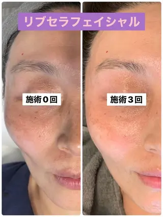 Private Salon Prunelle所属・プライベートサロン プリュネルのエステ・リラクイメージ