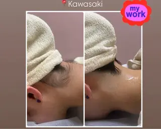 脱毛サロン エクボスタッフのエステ・リラクイメージ