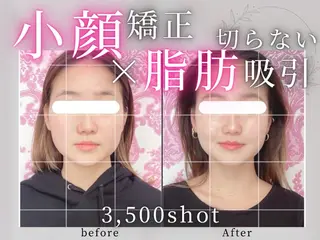 小顔矯正専門店 【RED】池田のエステ・リラクイメージ