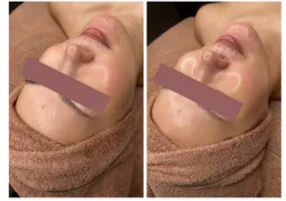 STELLA トータルビューティーのその他イメージ