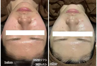 ENCHANT 脱毛.小顔.毛穴のエステ・リラクイメージ