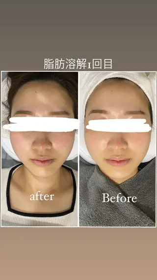 毛穴洗浄・痩身・脱毛 /アルカンジュのエステ・リラクイメージ