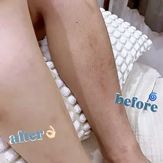 ハーブピーリング ante関内 青山のエステ・リラクイメージ