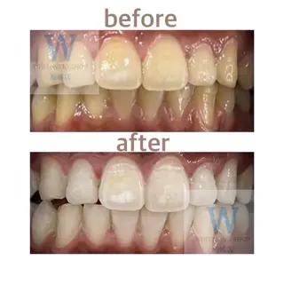 ホワイトニング ショップ船橋店🦷のエステ・リラクイメージ