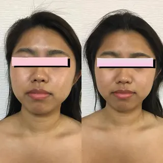 小顔筋膜矯正サロン桜Biscuit~サクラビスケット~所属・小顔/肩こり/脱毛 桜Bisucuitのエステ・リラクイメージ