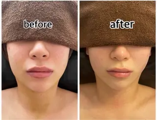 💎インディバ GEM💎indiba   healing room GEM所属・💎 GEM💎のエステ・リラクイメージ