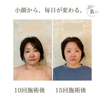 小顔サロンラヴィ　　船橋馬込沢店所属・小顔サロンラヴィ 船橋のエステ・リラクイメージ
