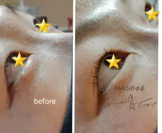 マツエク・マツパ Lemon grassのマツエク・マツパデザイン