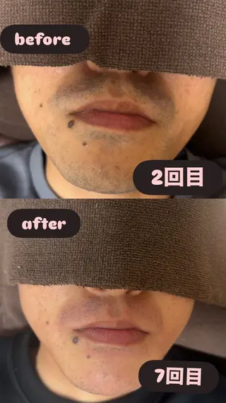 メンズ 菊池 雪乃のエステ・リラクイメージ