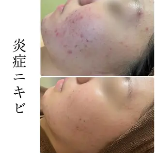 ハーブピーリング専門 BIOPLUS＋川崎のエステ・リラクイメージ