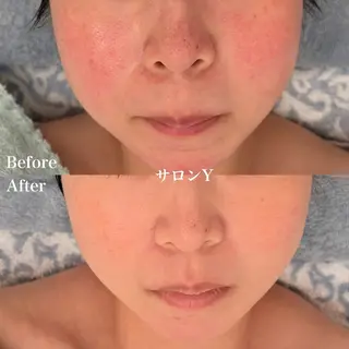 グリーンピール専門店 サロンY【大阪】のエステ・リラクイメージ