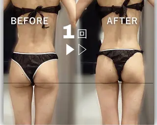 エステサロンNarcis〜ナルシス〜所属・脱毛＆痩身エステ Narcisのエステ・リラクイメージ