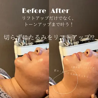 💎美容革命ラボ💎 大名店のエステ・リラクイメージ