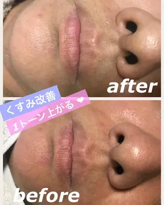 ミディアム カラー パーマ ヘアアレンジ メンズ キッズ ネイル マツエク・マツパ 四つ星サロン🎖 腸＆ニキビケアに特化のエステ・リラクイメージ