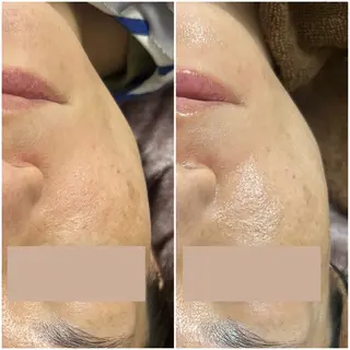 毛穴レス美肌へ🌿 看護師Abe🌼のエステ・リラクイメージ