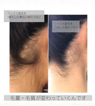 ワックス脱毛🌈 ESPOIRnocoのエステ・リラクイメージ