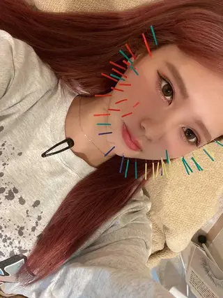 鍼灸整骨院Refine所属・鍼灸 Refineのその他イメージ