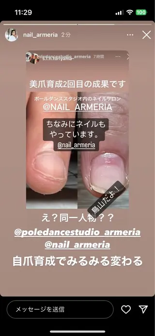 ネイル 大杉 泉翔のネイルデザイン