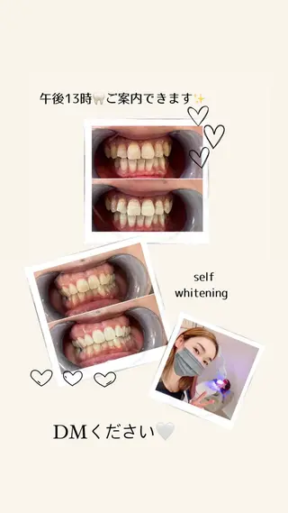 セルフホワイトニング Shineeのエステ・リラクイメージ