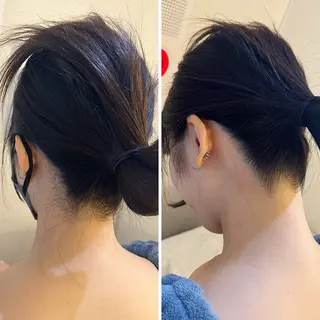 うなじ脱毛/美肌脱毛 LABELのエステ・リラクイメージ