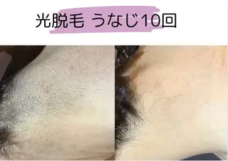 エステサロン TRINTEのエステ・リラクイメージ