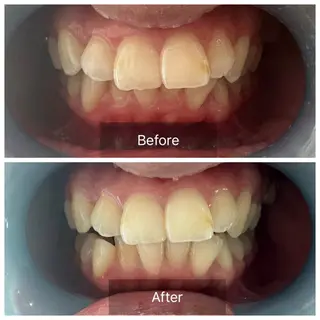 Ocouture所属・Ocouture ホワイトニング、小顔のその他イメージ