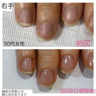 ネイル 自爪育成専門サロン エムロードゥ池下のネイルデザイン