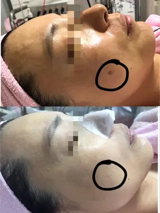 顔専門エステ プリエールビューティのエステ・リラクイメージ