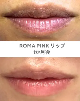 GrandAzure 大人の肌改善のエステ・リラクイメージ