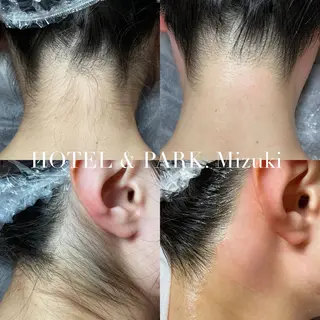 HOTEL&PARK . ワックス脱毛のエステ・リラクイメージ