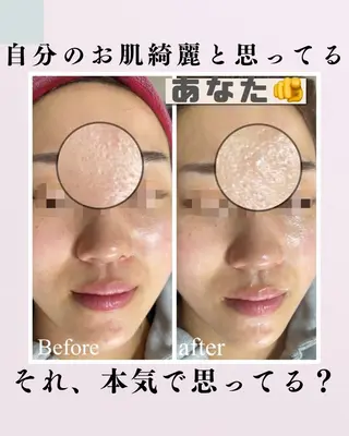 肌質改善サロン facialmoonのエステ・リラクイメージ