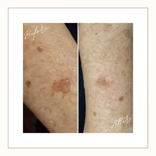 nouvelle  plume所属・ヌーベル プリュムのエステ・リラクイメージ